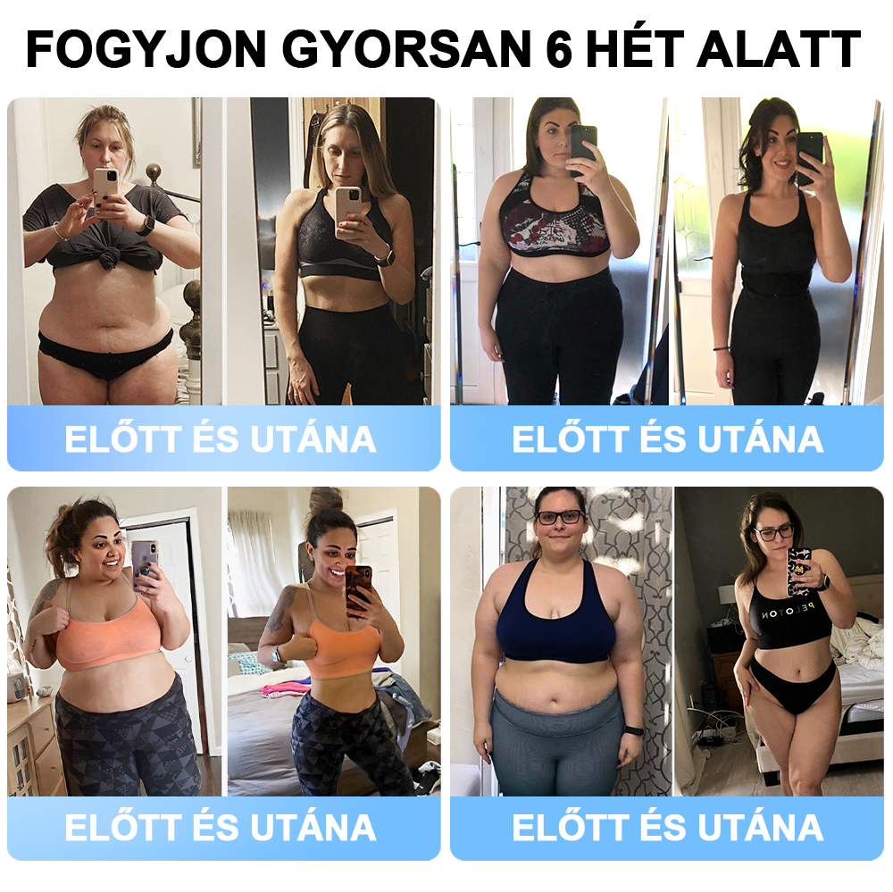 đFormaĂletÂź đ±Nano MikrotƱ Tapasz SMGT-GLP-1-tel Ă©s Matrixyl 3000-rel â FogyĂĄs, BĆrfeszesĂtĂ©s, VĂ©rcukorszint-tĂĄmogatĂĄs, InjekciĂł NĂ©lkĂŒl, 7 Napos EredmĂ©ny đ