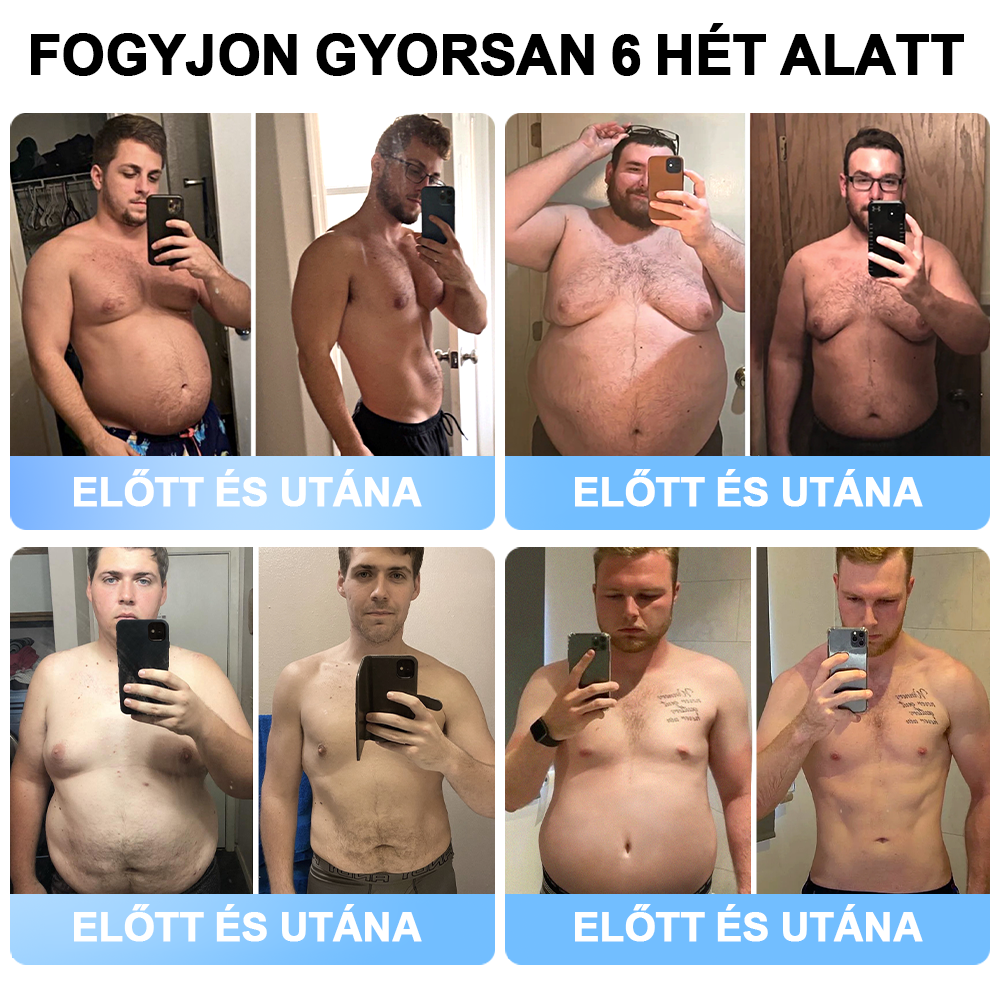 đFormaĂletÂź đ±Nano MikrotƱ Tapasz SMGT-GLP-1-tel Ă©s Matrixyl 3000-rel â FogyĂĄs, BĆrfeszesĂtĂ©s, VĂ©rcukorszint-tĂĄmogatĂĄs, InjekciĂł NĂ©lkĂŒl, 7 Napos EredmĂ©ny đ