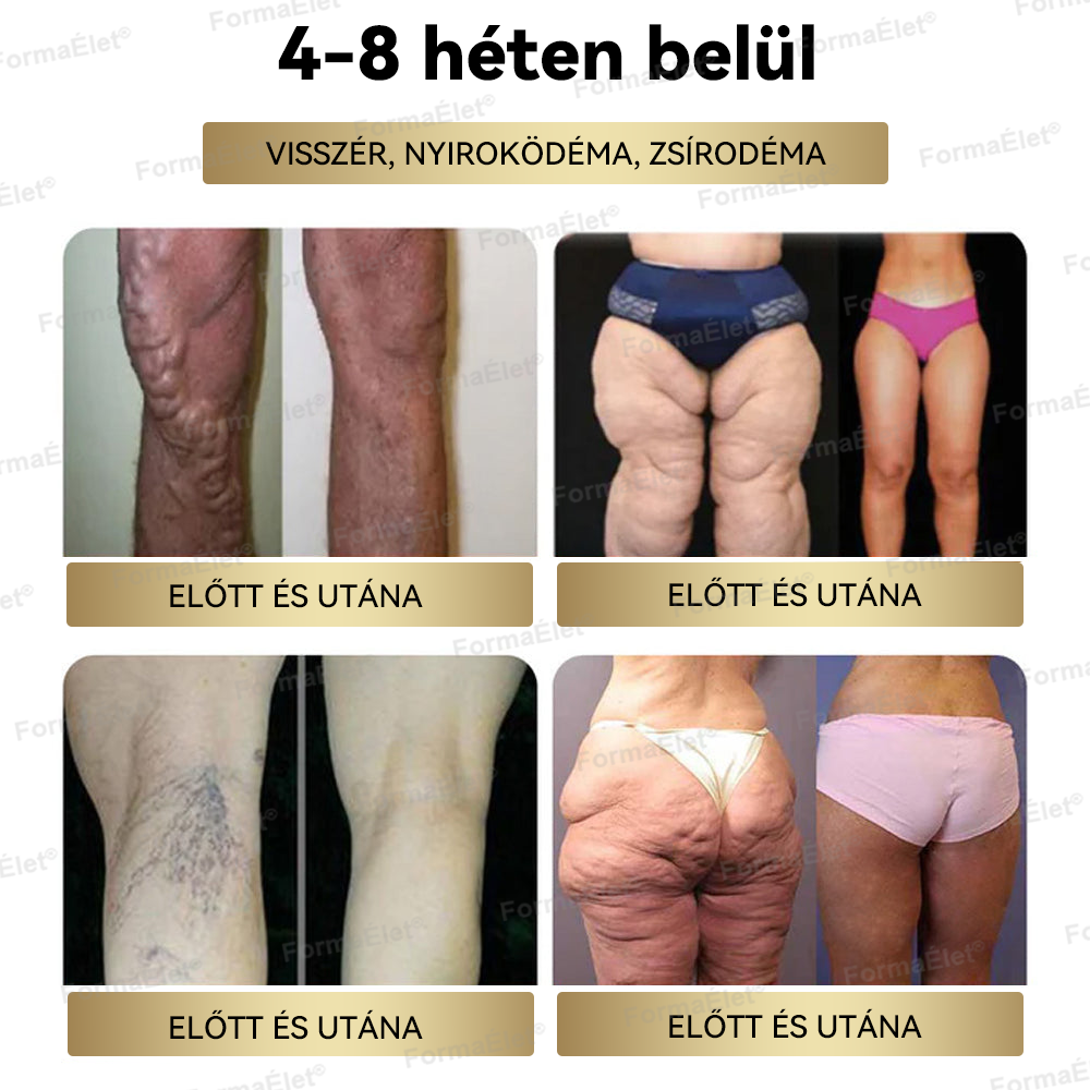 🎁OGYÉI ajánlásával | Hivatalos üzlet | FormaÉlet® GLP-1 Moringa Fogyókúrás és Egészségfokozó cseppek 🔥 (Élelmiszer-minőségű zsírégető – Az Obesity Society fejlesztése)🎁