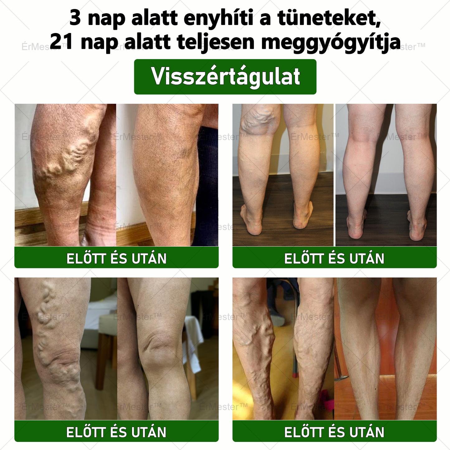 ☘️☘️ ÉrMester™ Természetes Vénás Javító Lábfürdő Gélgolyók