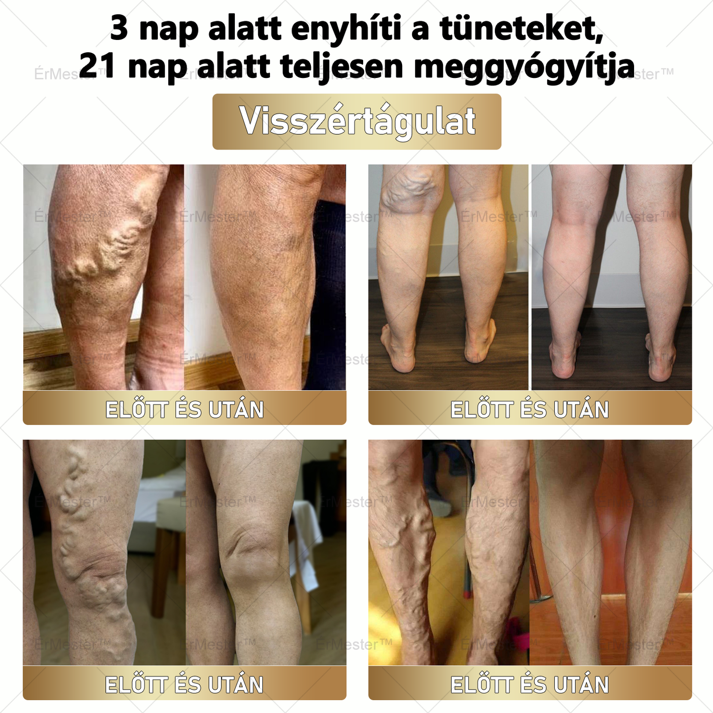 ⭐⭐ ÉrMester™ Természetes Vénás Javító Lábfürdő Gélgolyók