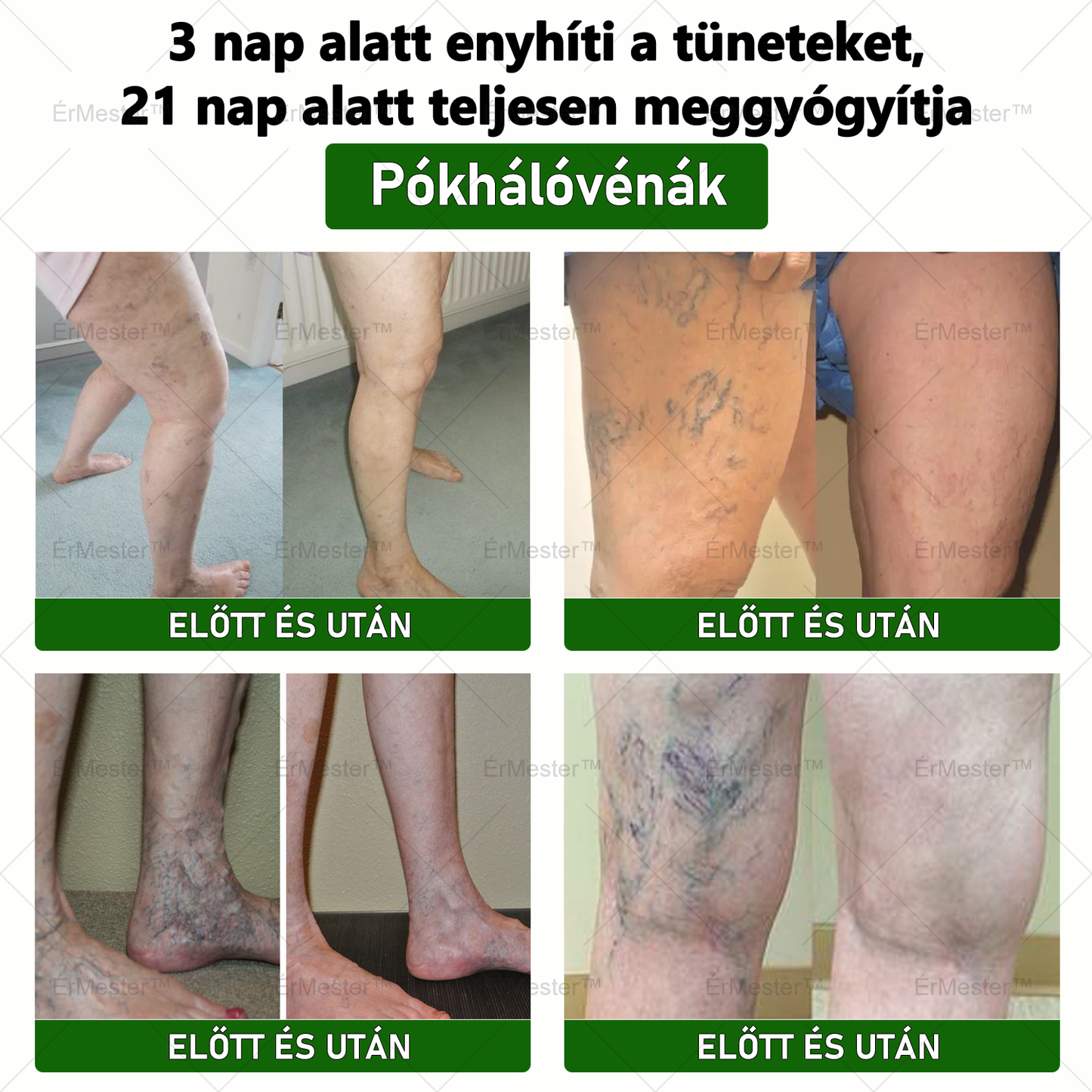 ☘️☘️ ÉrMester™ Természetes Vénás Javító Lábfürdő Gélgolyók