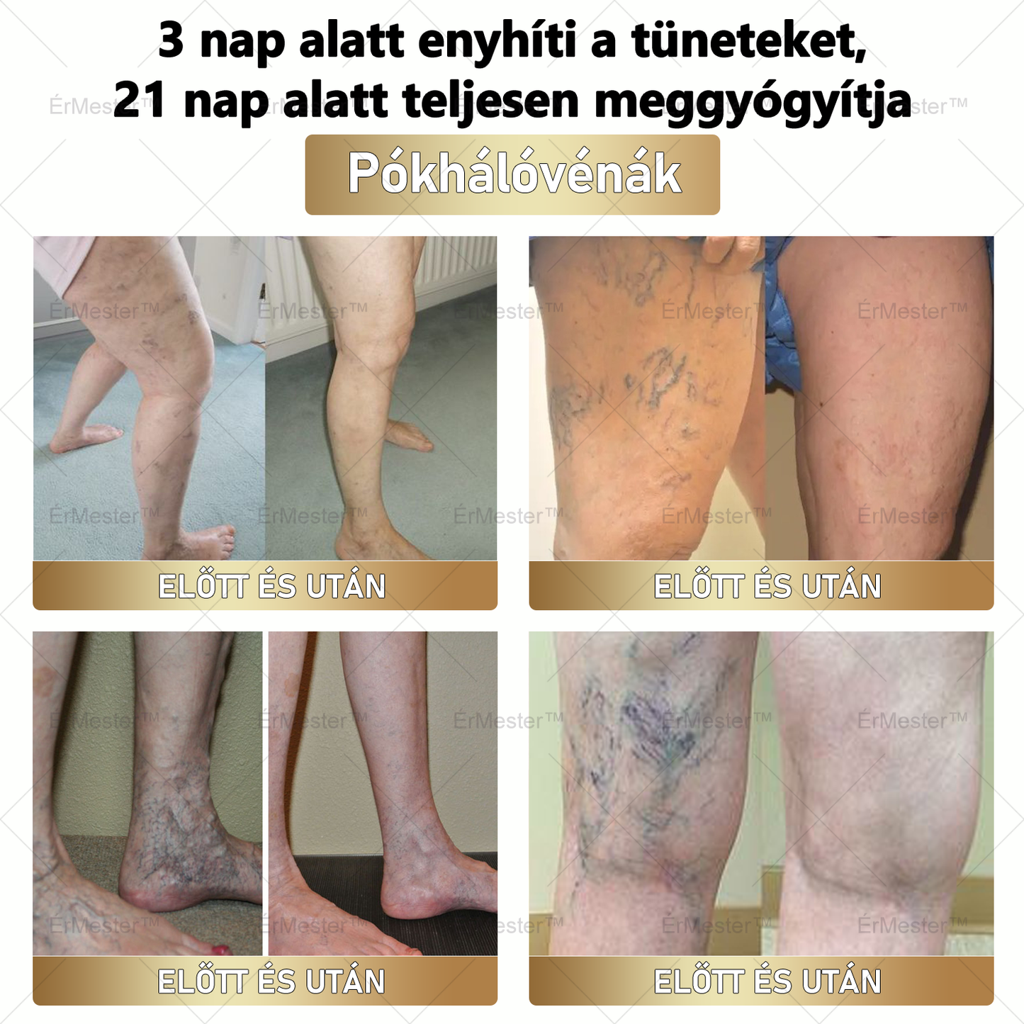 ⭐⭐ ÉrMester™ Természetes Vénás Javító Lábfürdő Gélgolyók