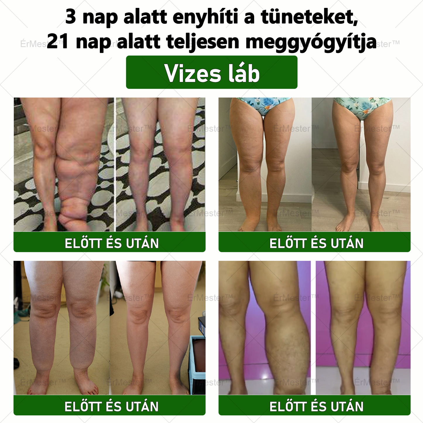 ☘️☘️ ÉrMester™ Természetes Vénás Javító Lábfürdő Gélgolyók