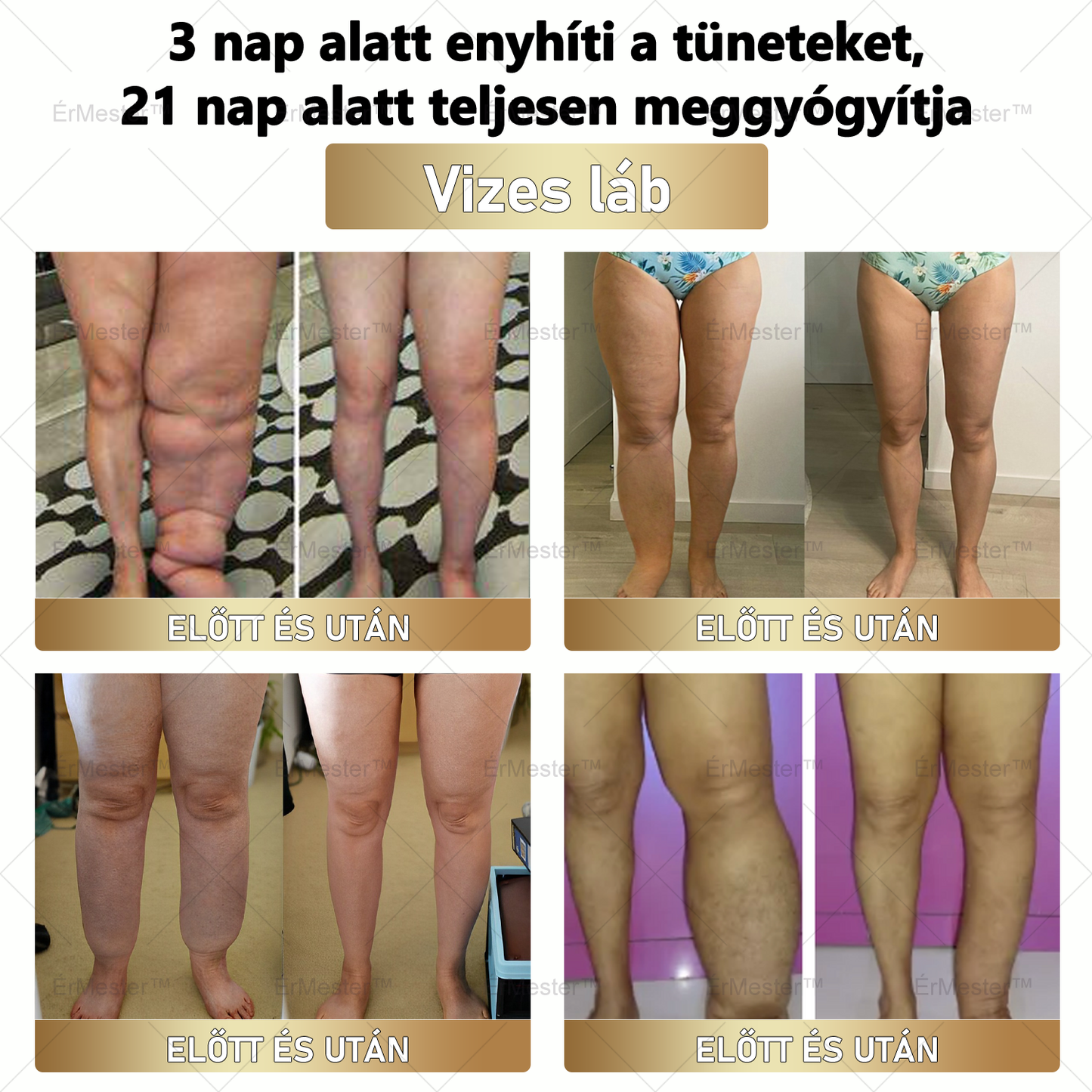 ⭐⭐ ÉrMester™ Természetes Vénás Javító Lábfürdő Gélgolyók
