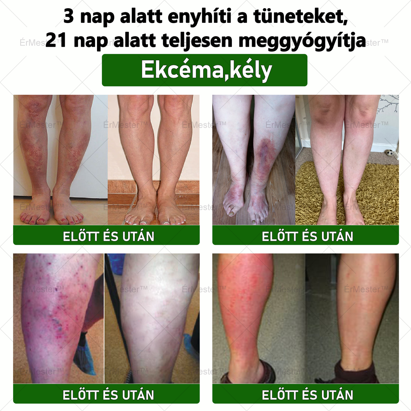 ☘️☘️ ÉrMester™ Természetes Vénás Javító Lábfürdő Gélgolyók