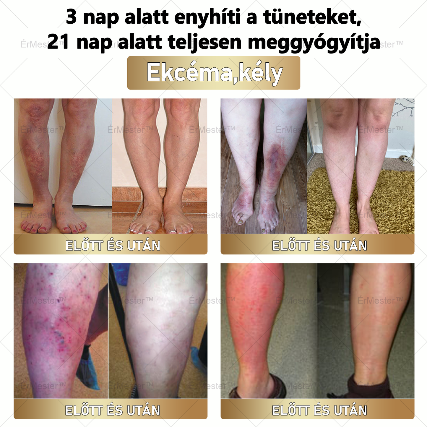 ⭐⭐ ÉrMester™ Természetes Vénás Javító Lábfürdő Gélgolyók