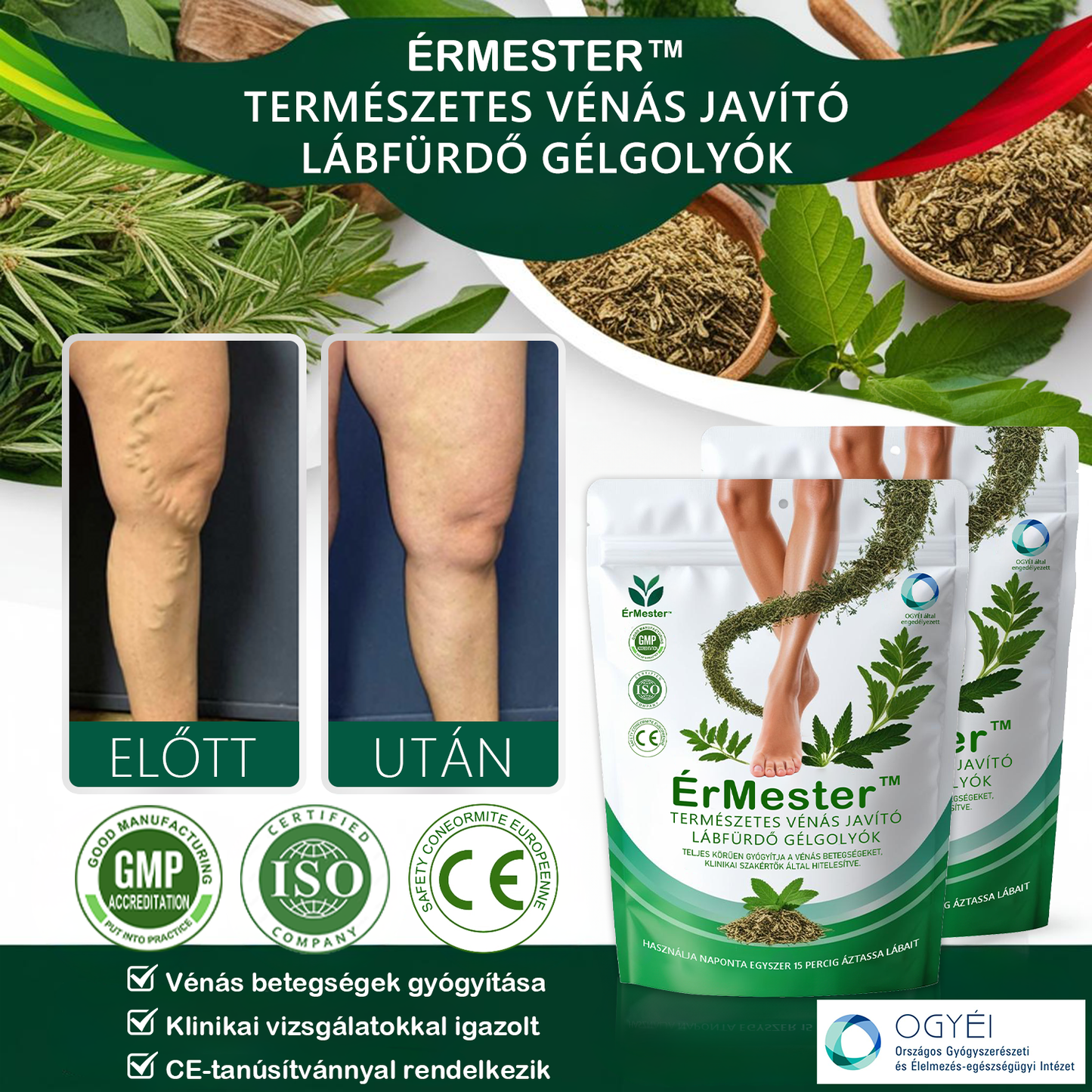 ❣️ ÉrMester™ Természetes Vénás Javító Lábfürdő Gélgolyók