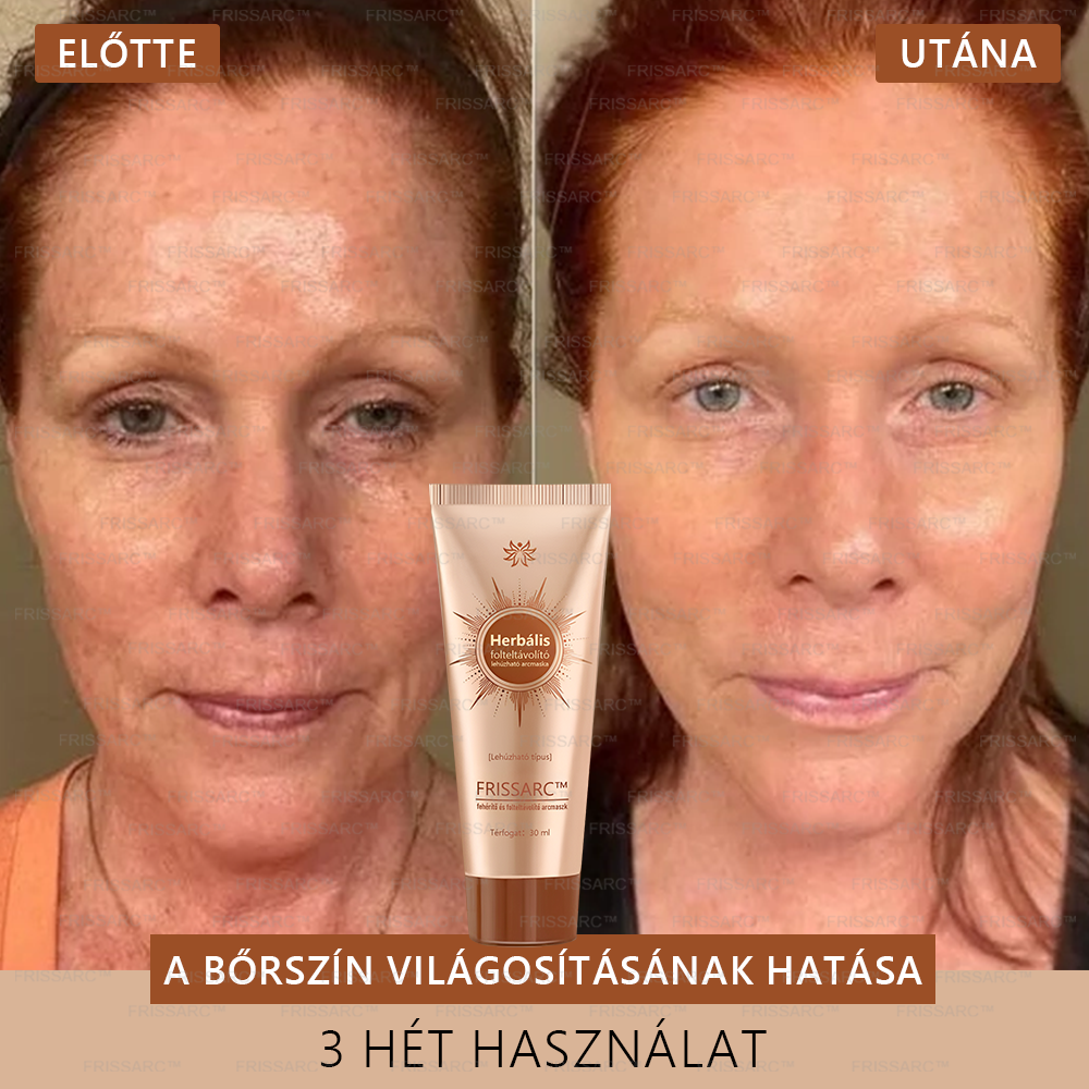 ✨ 𝐅𝐑𝐈𝐒𝐒𝐀𝐑𝐂™ Fehérítő És Folteltávolító Arcmaszk | Természetes összetevők tartósan eltüntetik a foltokat, szeplőket és napfoltokat🔥