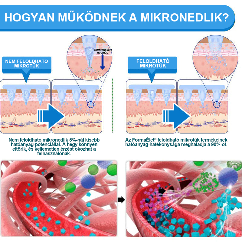 🎁FormaÉlet® 🌱Nano Mikrotű Tapasz SMGT-GLP-1-tel és Matrixyl 3000-rel – Fogyás, Bőrfeszesítés, Vércukorszint-támogatás, Injekció Nélkül, 7 Napos Eredmény 🎁